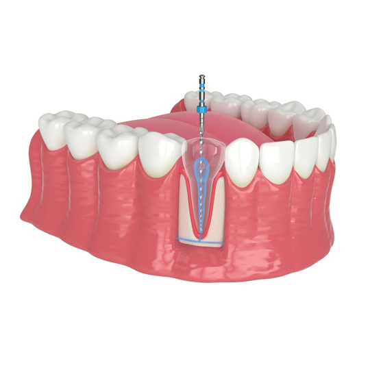 Endodoncia